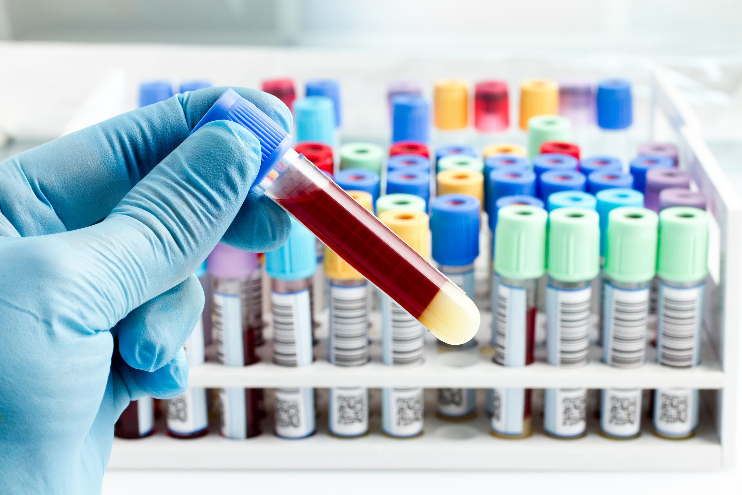 Lab services at ABQ ER & Hospital